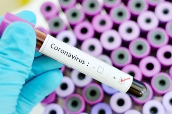 Virus Corona Diduga Benar Buatan Manusia