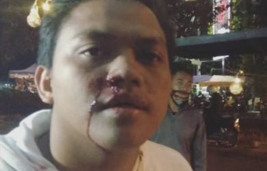 Ditembak Orang Tak Dikenal di Badan dan Wajah, Pemuda di Bandung Lapor Polisi