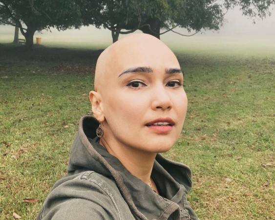 Feby Febiola Sembuh dari Kanker Ovarium