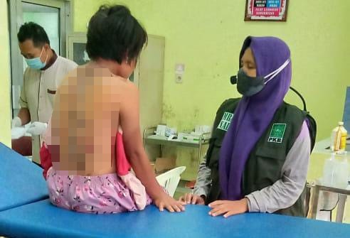 Gadis Muda di Brebes Diduga Jadi Korban Kekerasan Bapak Tiri