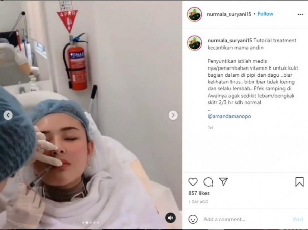 Beberapa Bagian Wajahnya Disuntik, Amanda Manopo Dianggap Netizen Tak Bersyukur