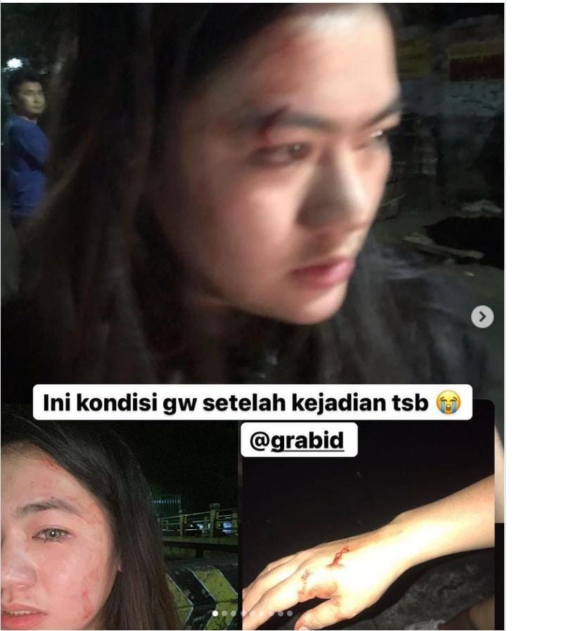 Penumpang Taksi Online Digampar dan Ditendang, Kisah Perempuan Ini Viral