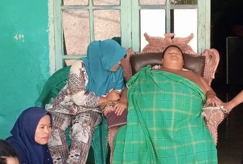 Bocah 11 Tahun Berberat Badan 126 Kilogram di Bekasi Meninggal saat Dirawat di RSUD Bekasi