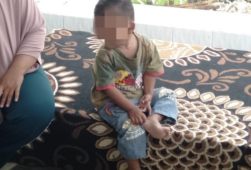 Bocah Pemakan Sandal Jepit di Bekasi Alami Gangguan Psikolog, Bisa Disembuhkan