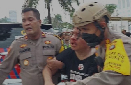 Selain di Alat Vital, Ade Armando Juga Perdarahan di Otak usai Dikeroyok