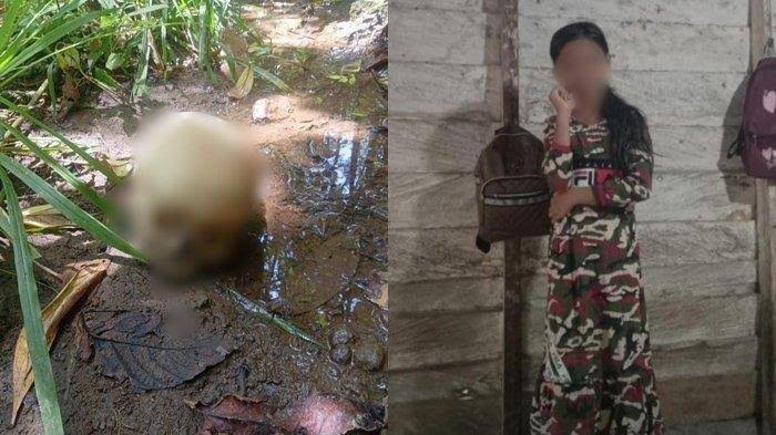 Sadis Banget! Gadis Kecil 10 Tahun Digorok dan Dimutilasi Sepupunya usai Dirudapaksa