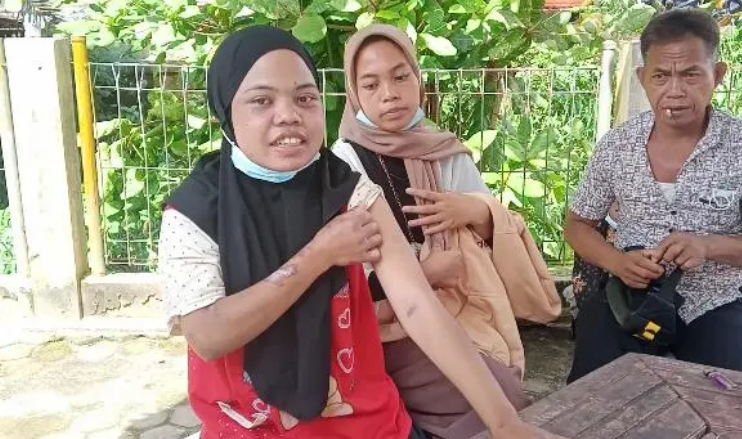 Istri Polisi Aniaya Pembantunya Siram Dengan Air Panas Dan Ancam Digantung Tapi Tak Ditahan 2452