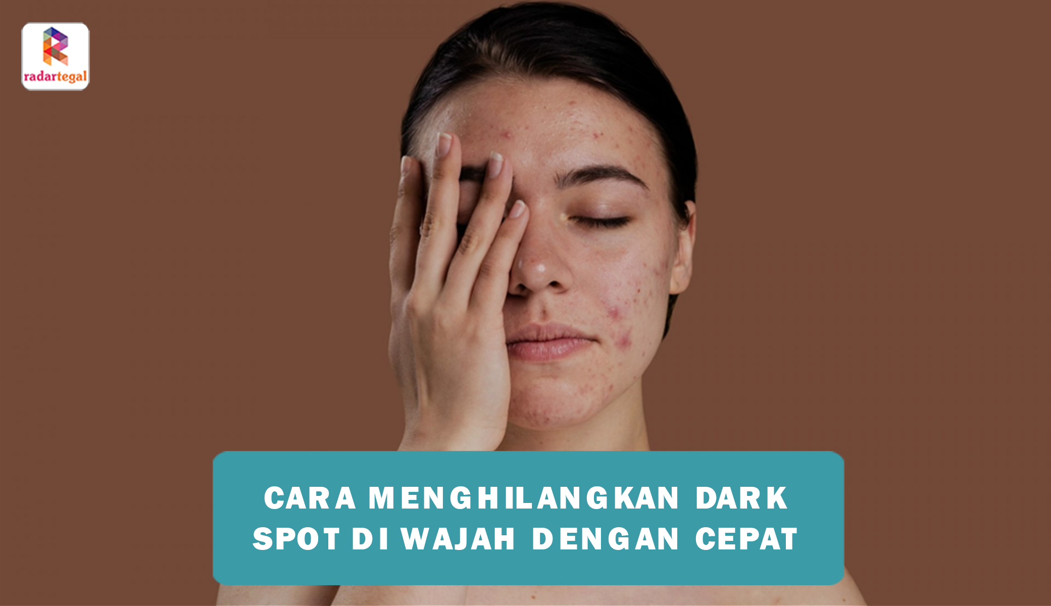 4 Cara Menghilangkan Dark Spot di Wajah dengan Cepat dan Efektif, Terbukti Bikin Kulit Bersih dan Cerah
