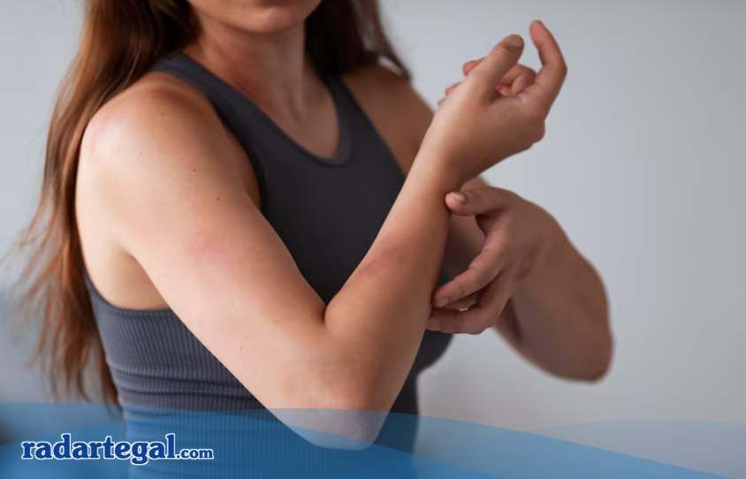 Cek Fakta Mitos Lebam pada Bagian Tubuh, Benarkah Karena Dijilat Setan?