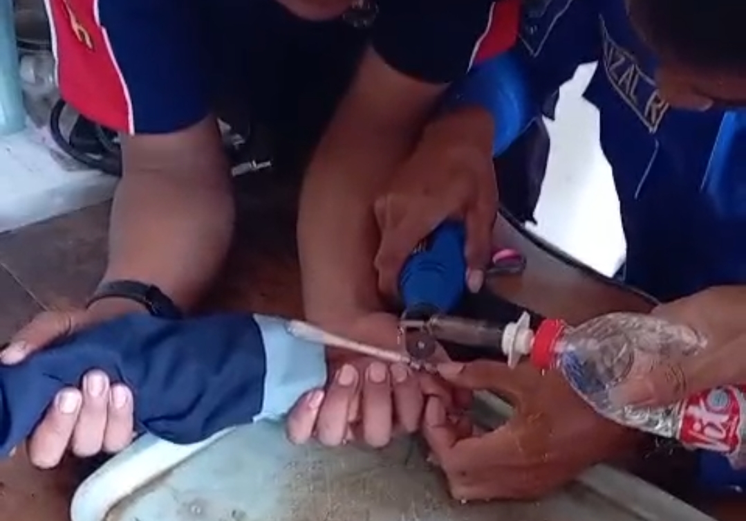 Jari Membengkak karena Ring Besi, Bocah di Brebes Datangi Damkar
