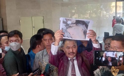 Temukan Goresan di Leher, Kamaruddin Simanjuntak Makin Yakin Brigadir Nopriansyah Dibunuh  