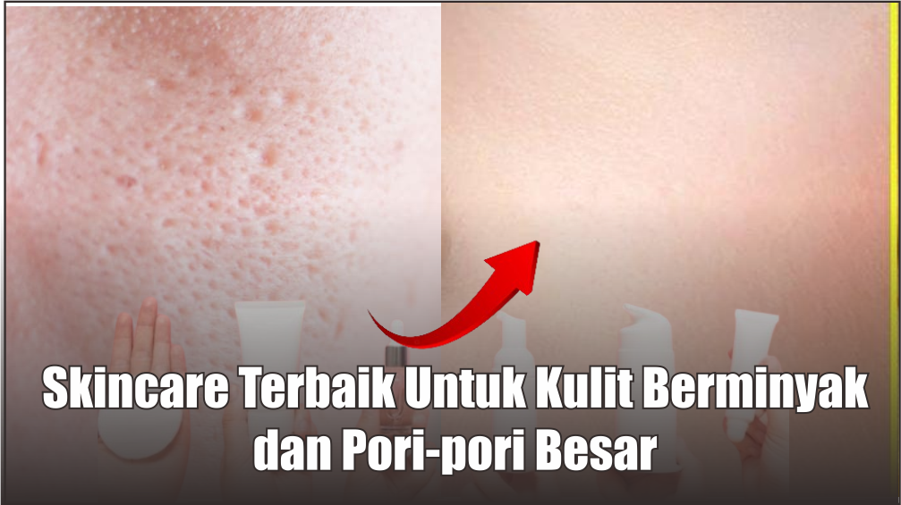 5 Rekomendasi Skincare Untuk Kulit Berminyak dan Berpori-pori, Kulit Mulus Glowing dan Kencang