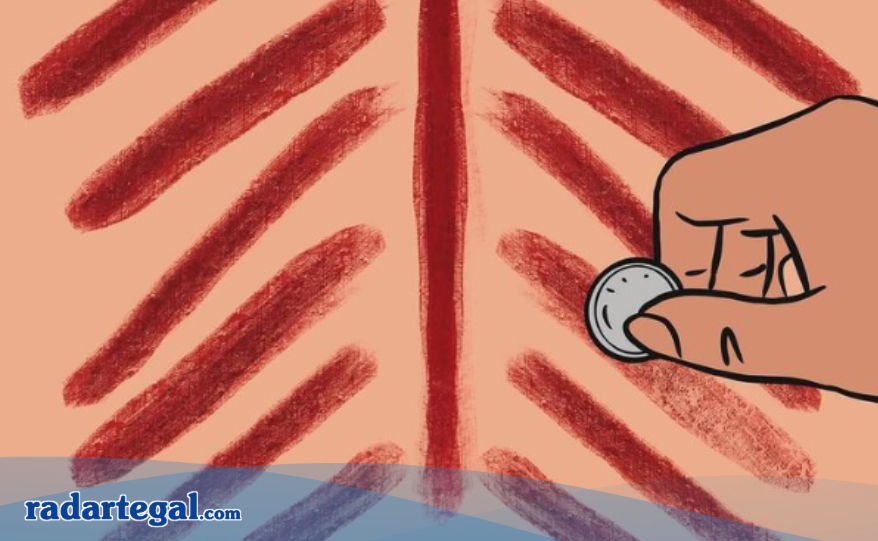 Fakta Medis di Balik Mitos Kerokan, Mengobati Masuk Angin?