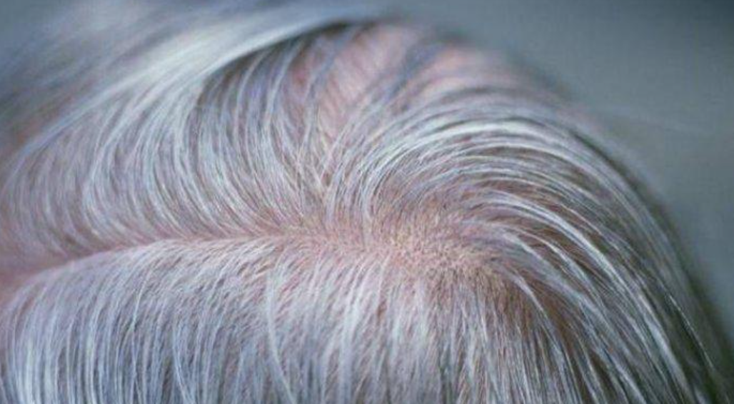 Mitos tentang Uban Rambut, Dicabut Bikin Lebih Banyak? Simak Faktanya