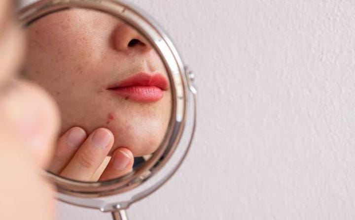 5 Tips Sederhana Merawat Skin Barrier agar Tetap Sehat, No 2 Terlihat Mudah Tapi Susah Diterapkan 