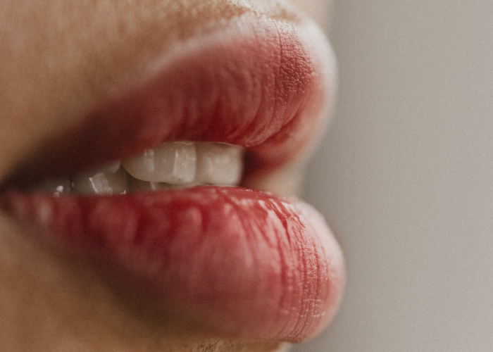 Kenali Bahaya Melakukan Kebiasaan Buruk Mencabut Kulit Bibir Kering, Luka Hingga Infeksi