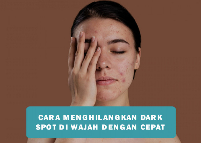 4 Cara Menghilangkan Dark Spot di Wajah dengan Cepat dan Efektif, Terbukti Bikin Kulit Bersih dan Cerah