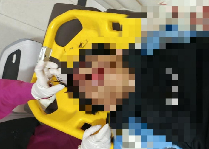Tragis! Pelajar SMK di Tegal Meninggal Dunia Usai Menjadi Korban Tawuran di Dukuhwringin