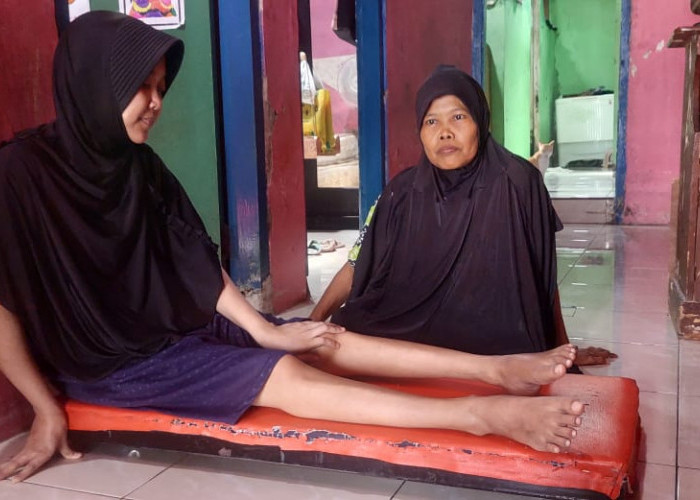 Kisah Pilu Anis, Warga Pagongan Kabupaten Tegal Penderita Penyakit Multiple Sclerosis