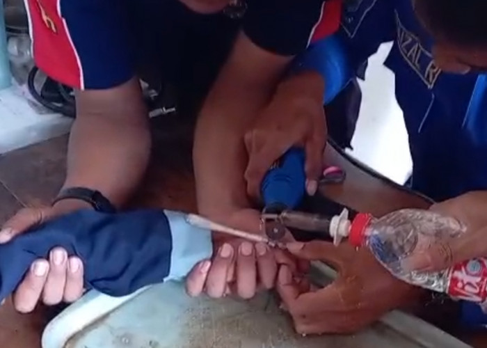 Jari Membengkak karena Ring Besi, Bocah di Brebes Datangi Damkar