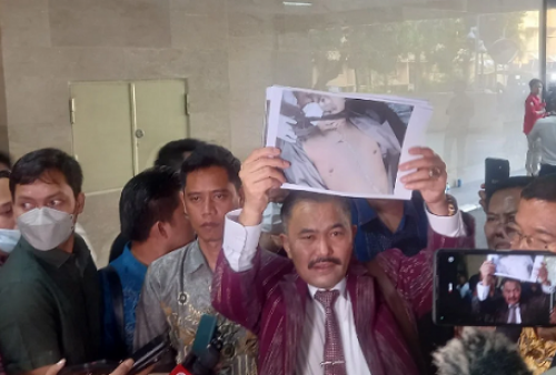 Temukan Goresan di Leher, Kamaruddin Simanjuntak Makin Yakin Brigadir Nopriansyah Dibunuh  