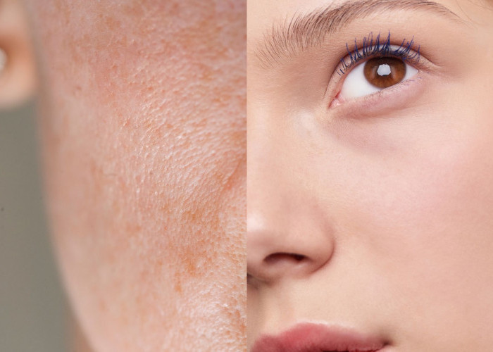 6 Skincare Rutin untuk Mengatasi Tekstur Kulit Gradakan, Wajah Auto Flawless