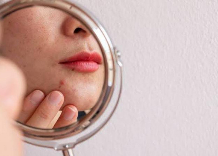 5 Tips Sederhana Merawat Skin Barrier agar Tetap Sehat, No 2 Terlihat Mudah Tapi Susah Diterapkan 