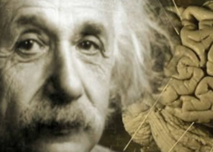 Fakta Pencurian Otak Albert Einstein: Kini Tersimpan di Museum Mutter