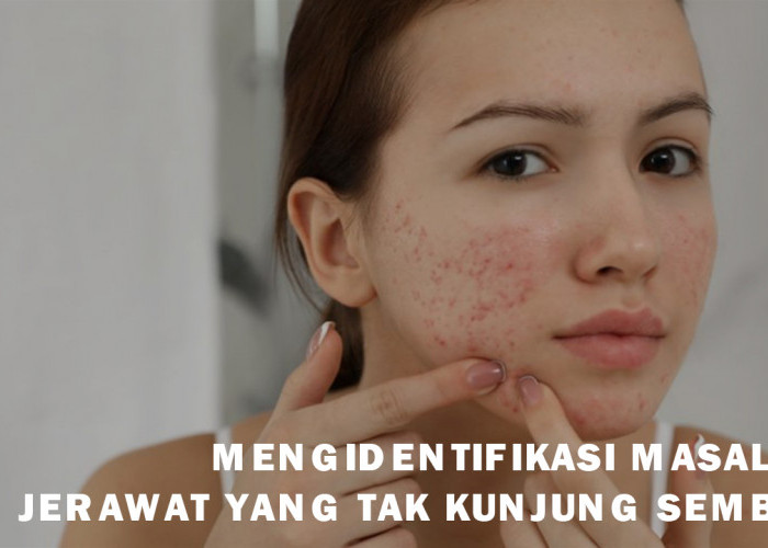 Jerawat Tak Kunjung Sembuh? Jangan-Jangan Kamu Terkena Skin Picking Disorder