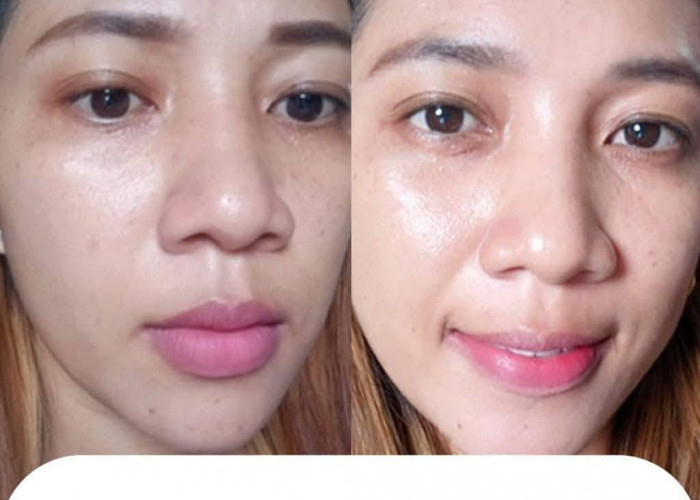 Rahasia Kulit Cerah, Sehat, dan Anti Kusam yang Selama Ini Kamu Cari 