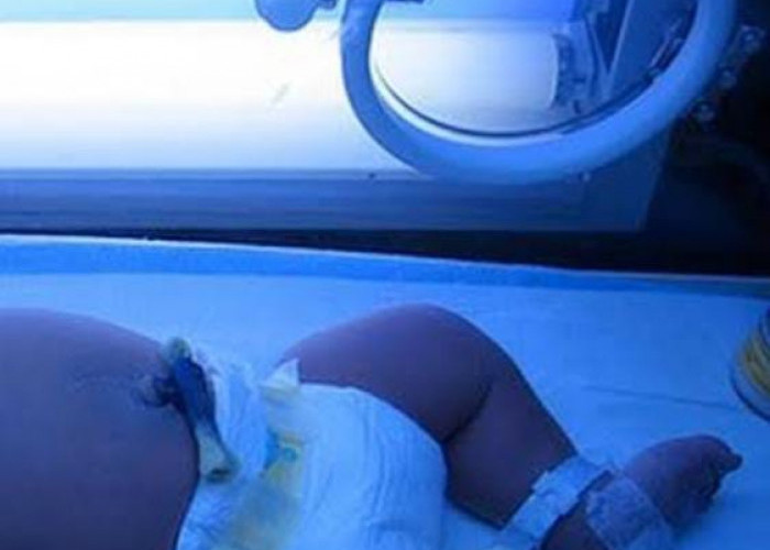 Viral Bayi Prematur Meninggal usai Dibuat Konten, Catat Pentingnya Inkubator Digunakan 