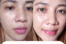 Rahasia Kulit Cerah, Sehat, dan Anti Kusam yang Selama Ini Kamu Cari 